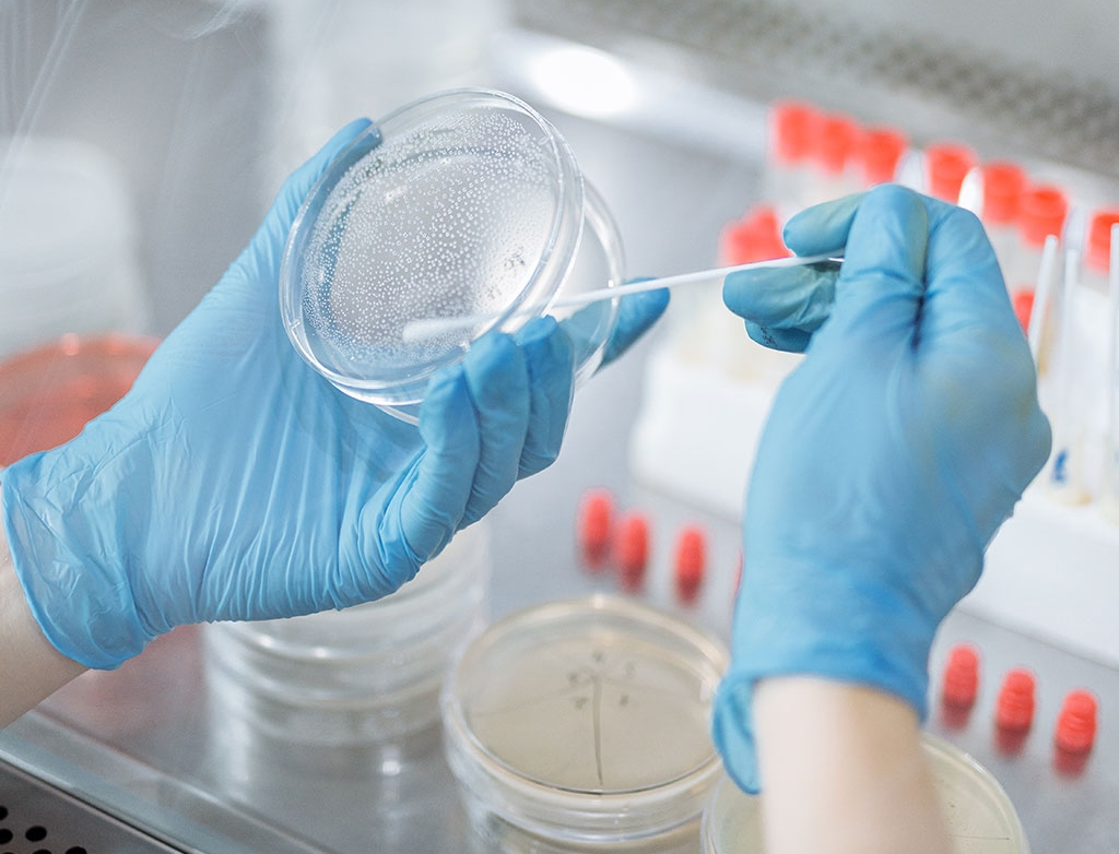 Análisis microbiológico